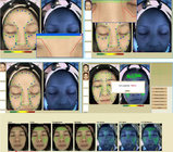 analizzatore facciale 40W della pelle dell'analizzatore della pelle di dermatologia 3d della macchina facciale di analisi